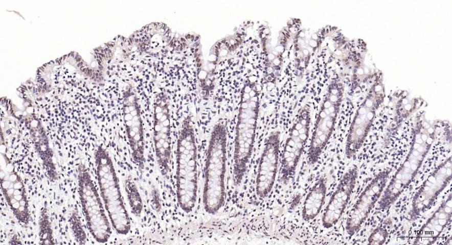Anti-PI3Kβ Polyclonal Antibody