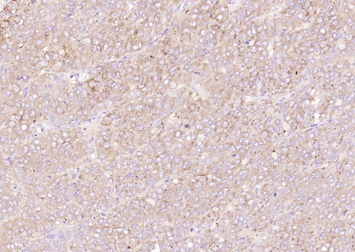 Anti-SAA1 Polyclonal Antibody