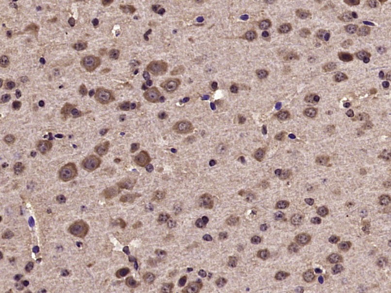 Anti-Phospho-Tyk2 (Tyr1054, 1055) Polyclonal Antibody