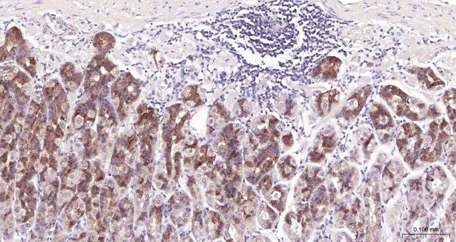 Anti-PI3Kβ Polyclonal Antibody
