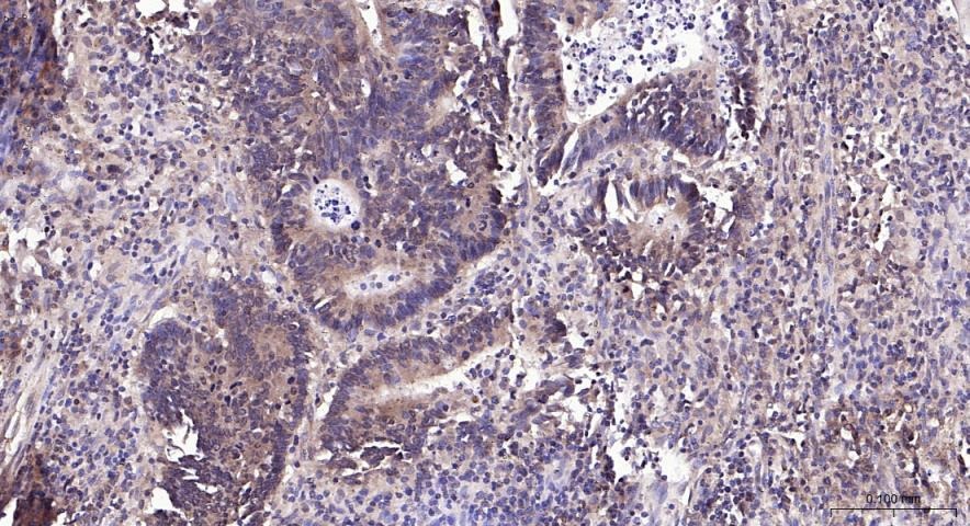 Anti-PI3Kβ Polyclonal Antibody