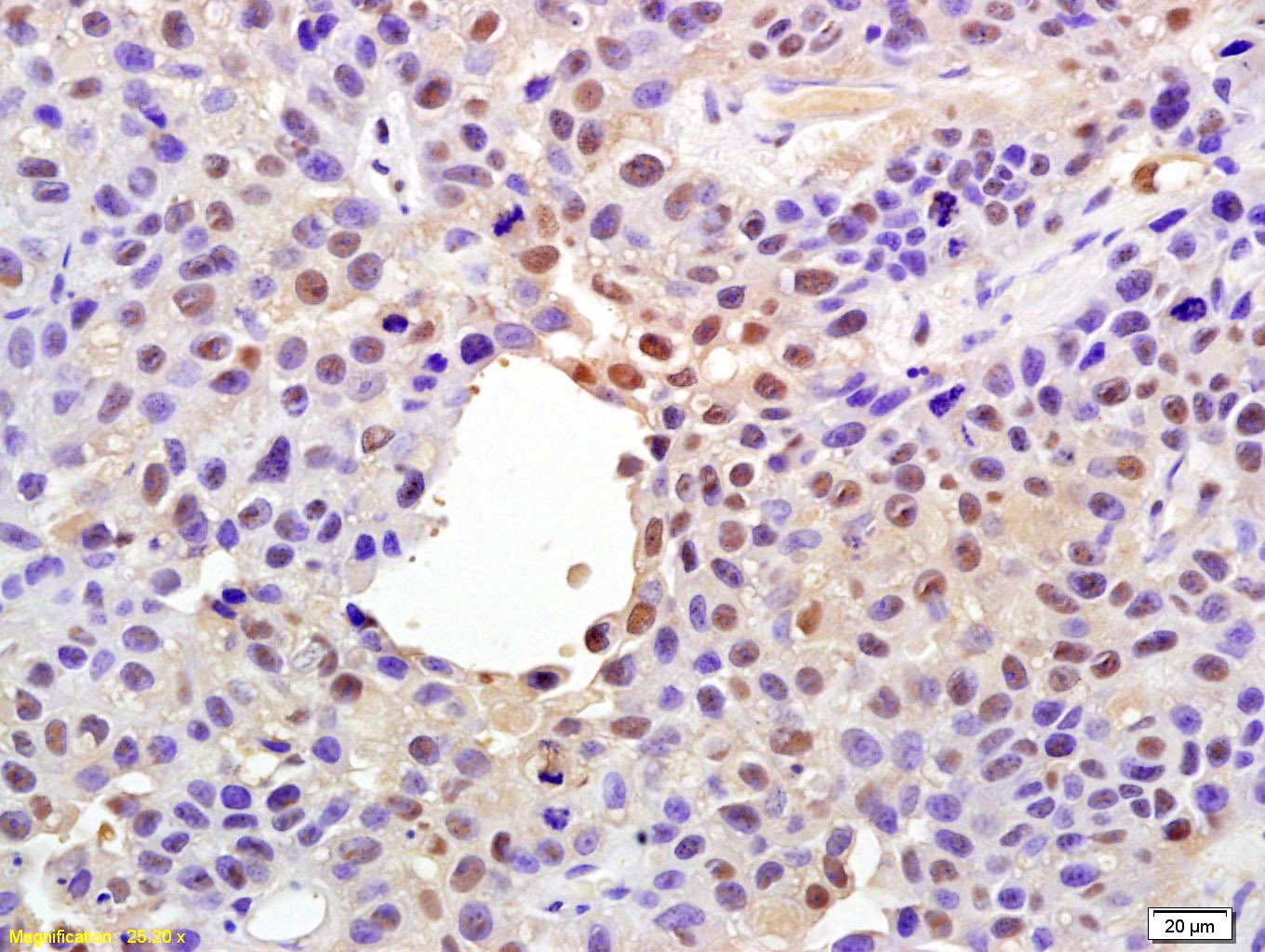 Anti-Phospho-YAP1 (Ser127) Polyclonal Antibody