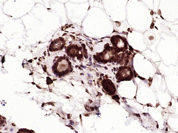 Anti-Phospho-YAP1 (Tyr407) Polyclonal Antibody