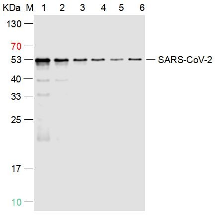 Anti-SARS-CoV-2 (2019-nCoV) Nucleocapsid Antibody (2Q299)