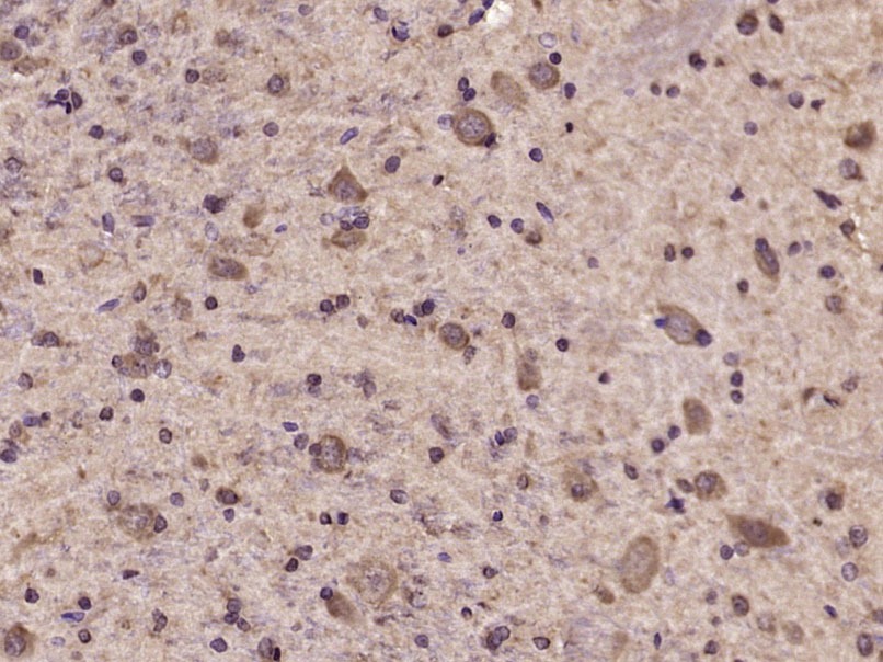 Anti-Phospho-Tyk2 (Tyr1054, 1055) Polyclonal Antibody