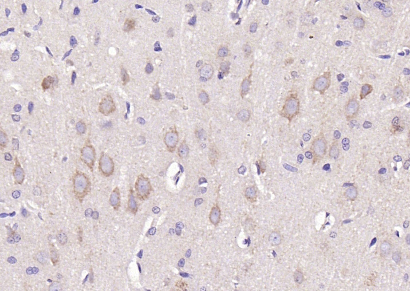 Anti-PI3 Kinase Class 3 Polyclonal Antibody