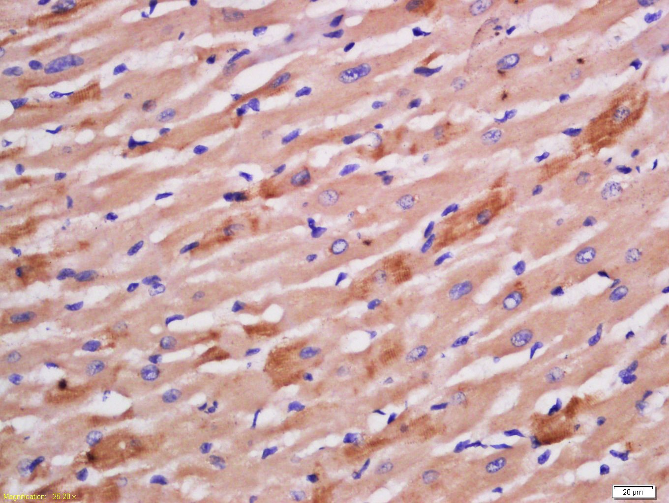 Anti-Sarcomeric Alpha Actinin Polyclonal Antibody