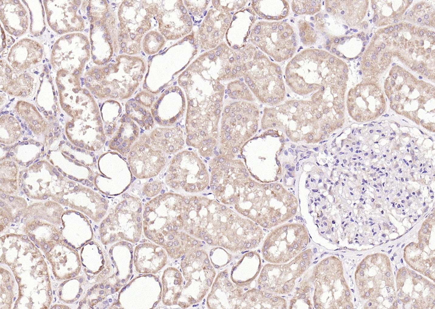 Anti-PI3 Kinase Class 3 Polyclonal Antibody