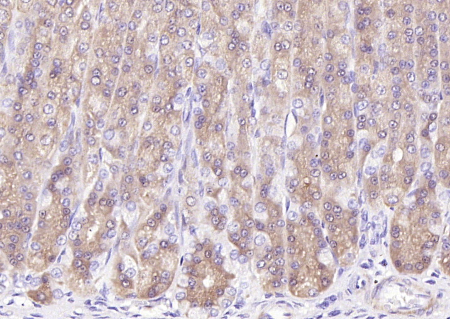 Anti-PI3 Kinase Class 3 Polyclonal Antibody