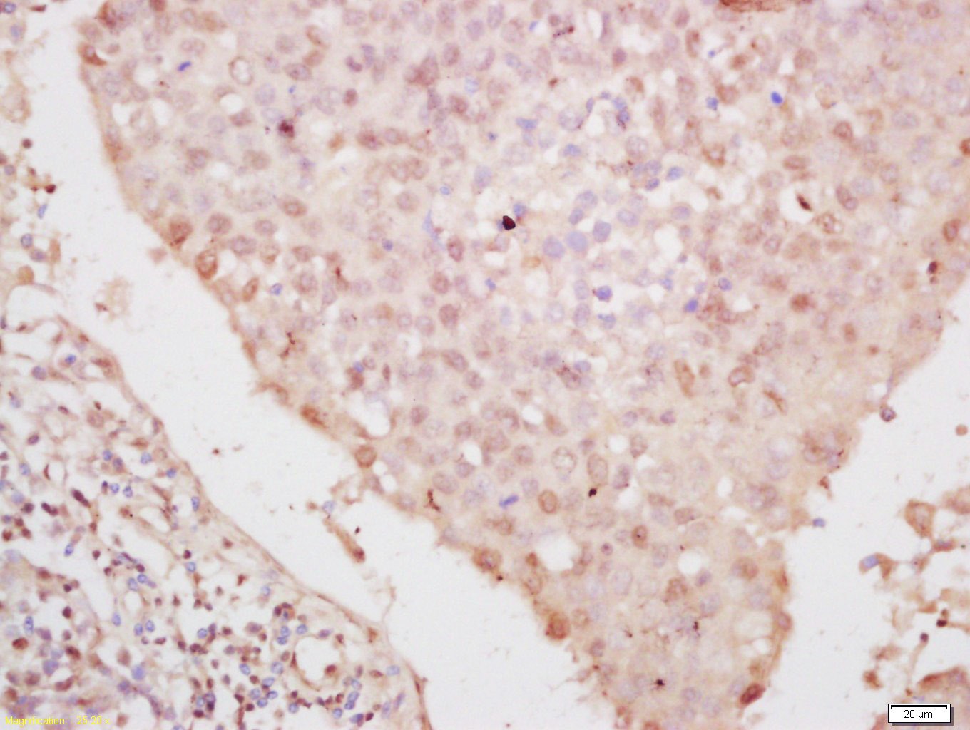 Anti-Phospho-YAP1 (Ser127) Polyclonal Antibody