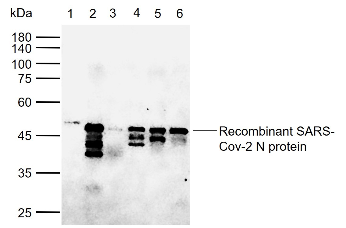 Anti-SARS-CoV-2 (2019-nCoV) Nucleocapsid Antibody (1Z747)