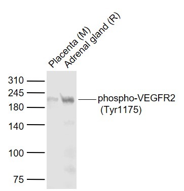 Anti-Phospho-VEGFR2/KDR (Tyr1175) Polyclonal Antibody