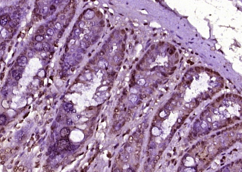 Anti-S6K1/RPS6KB1 Polyclonal Antibody