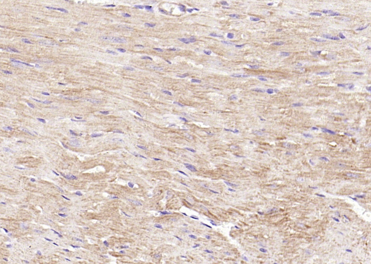 Anti-PI3 Kinase Class 3 Polyclonal Antibody