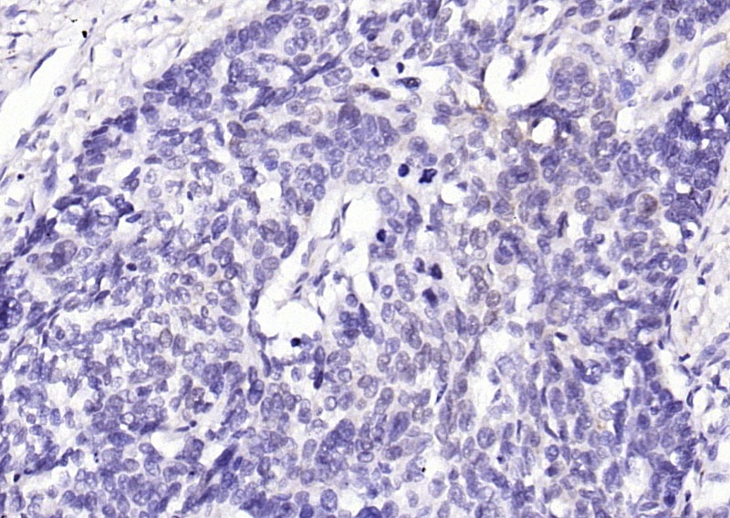 Anti-Phospho-YAP1 (Tyr407) Polyclonal Antibody