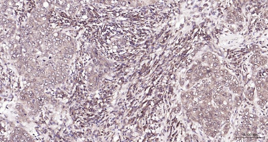 Anti-PI3Kβ Polyclonal Antibody