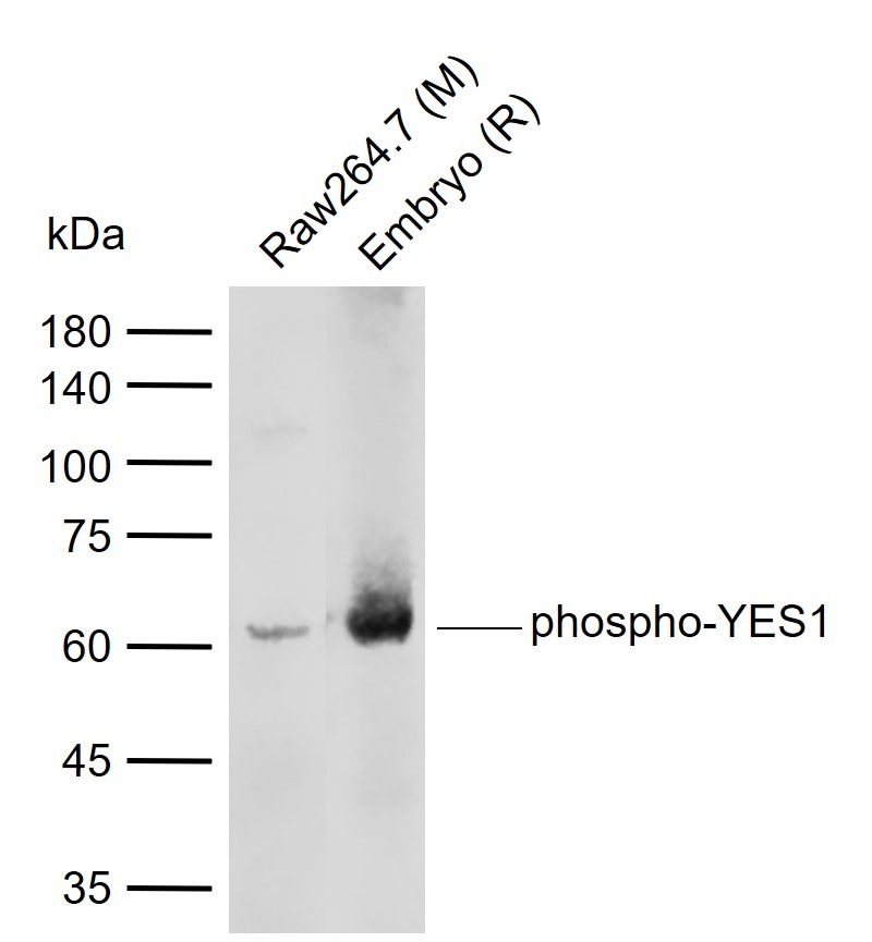 Anti-Phospho-YES1 (Tyr426) Polyclonal Antibody