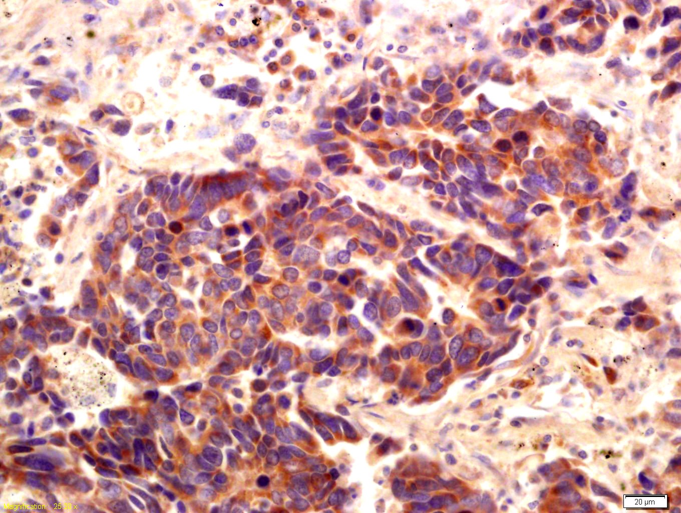 Anti-PI3 Kinase Class 3 Polyclonal Antibody