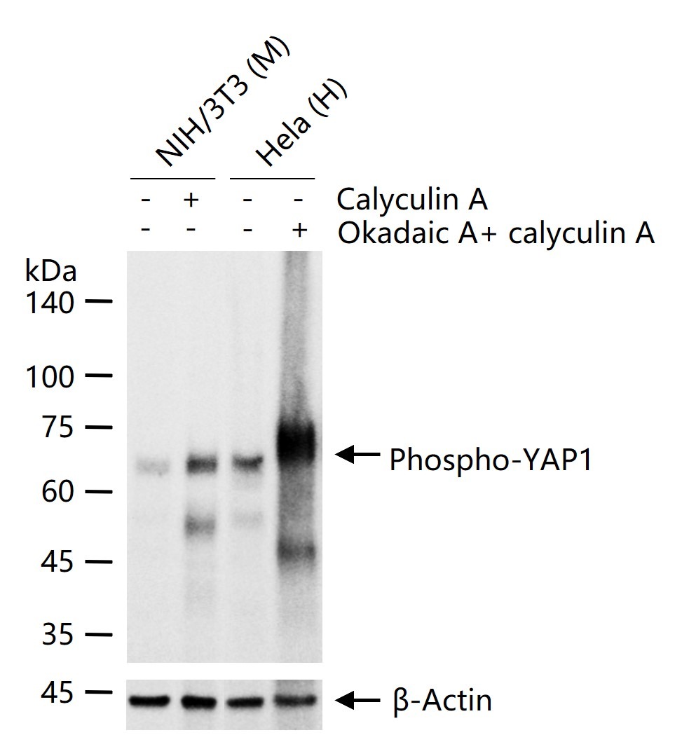 Anti-Phospho-YAP1 (Ser127) Antibody (5B8)