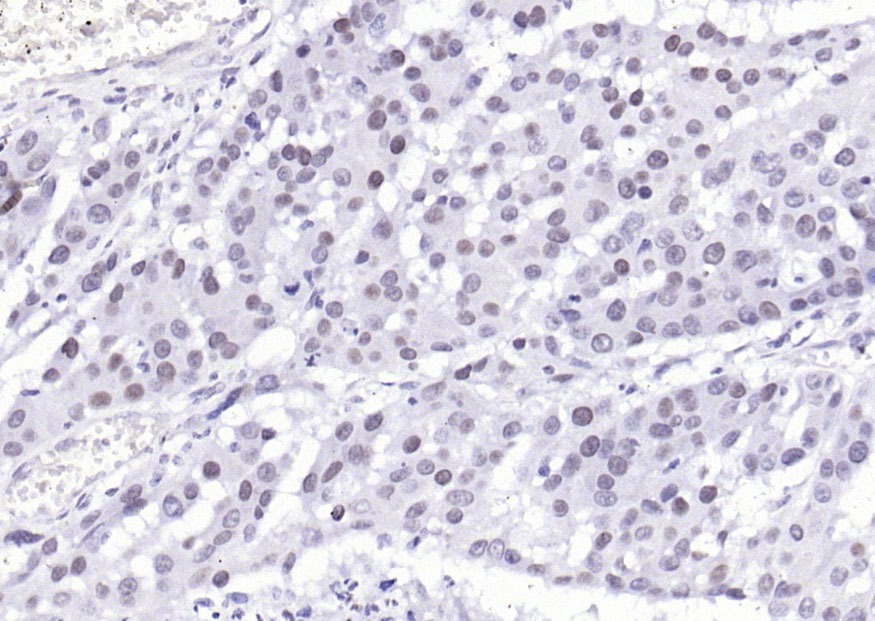 Anti-Phospho-YAP1 (Tyr407) Polyclonal Antibody