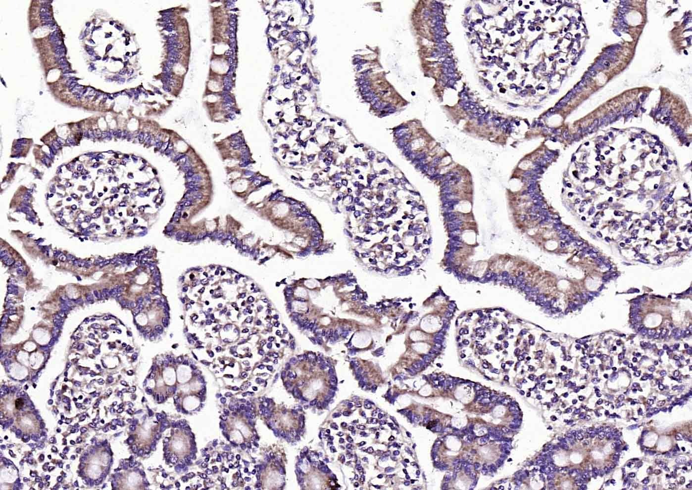 Anti-SAA1 Polyclonal Antibody