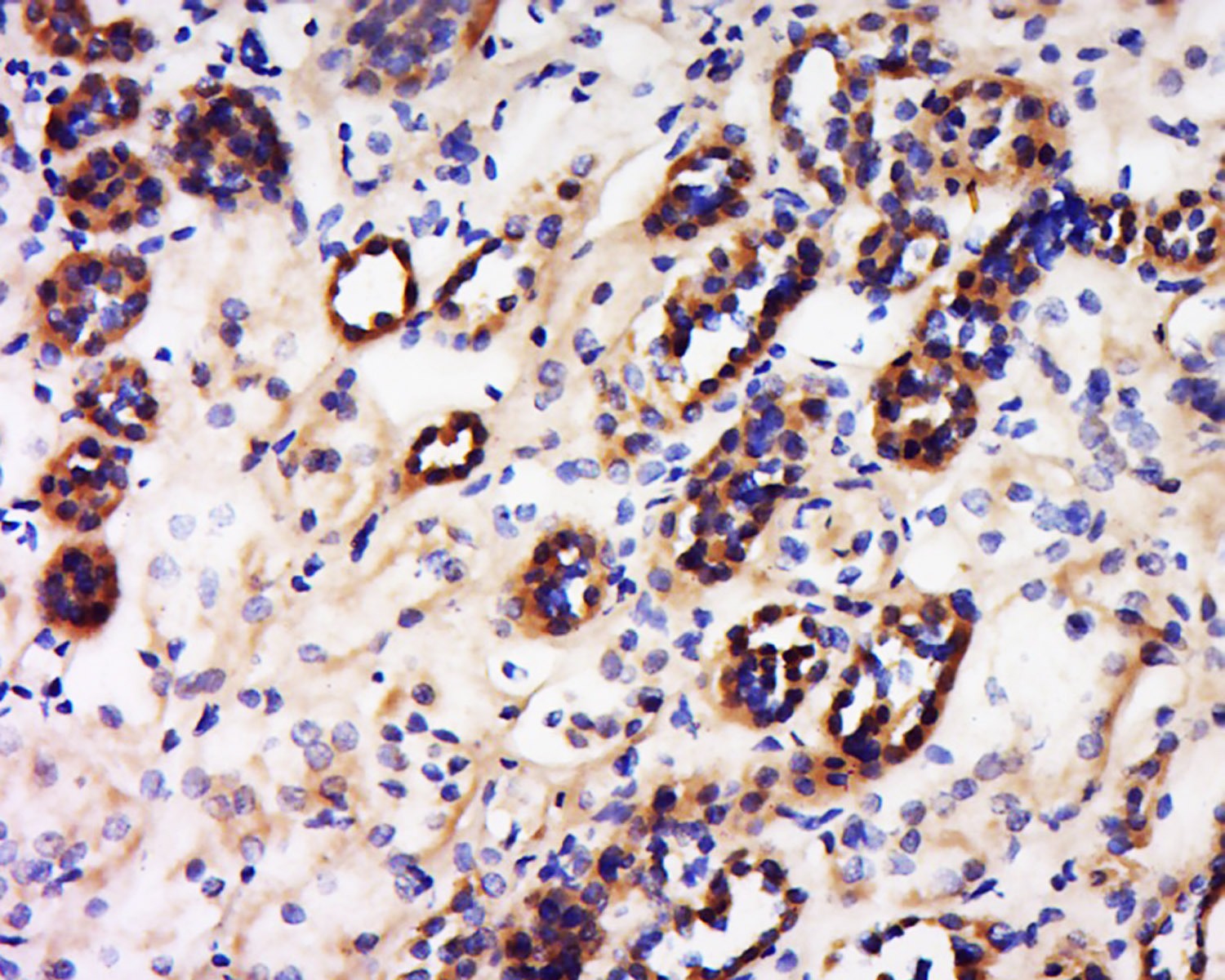 Anti-Phospho-VEGFR2/KDR (Tyr1059) Polyclonal Antibody