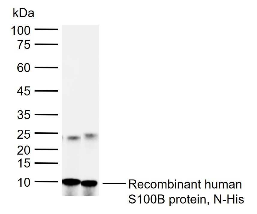 Anti-S100B Polyclonal Antibody