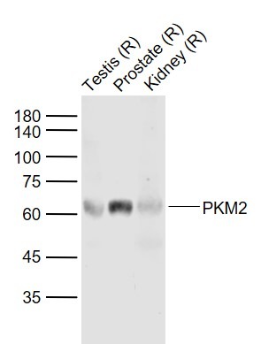 Anti-PKM2 Polyclonal Antibody 2