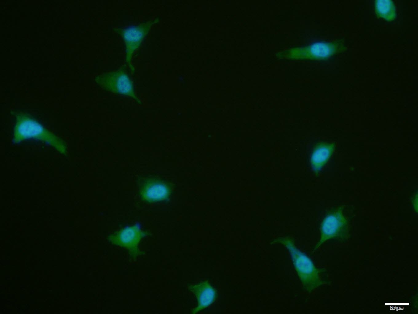 Anti-PKM2 Polyclonal Antibody