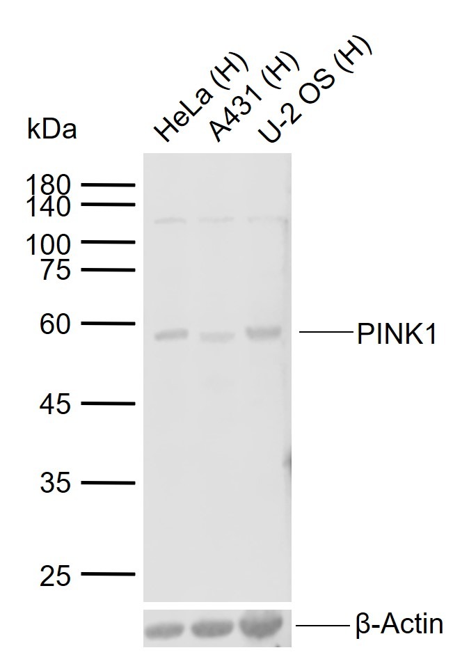 Anti-PINK1 Polyclonal Antibody