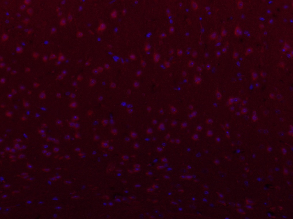Anti-PIEZO1 Polyclonal Antibody