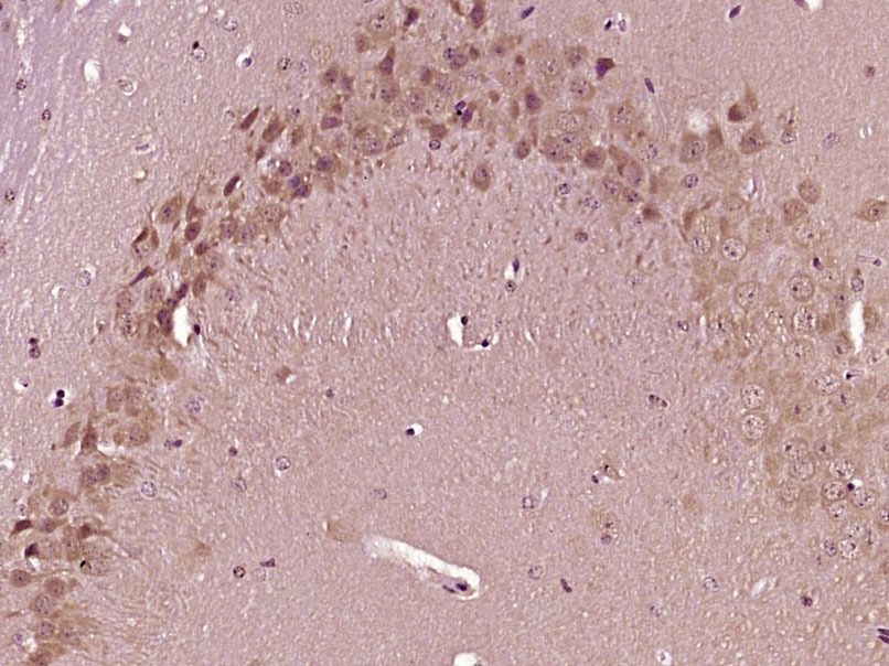 Anti-PIEZO1 Polyclonal Antibody