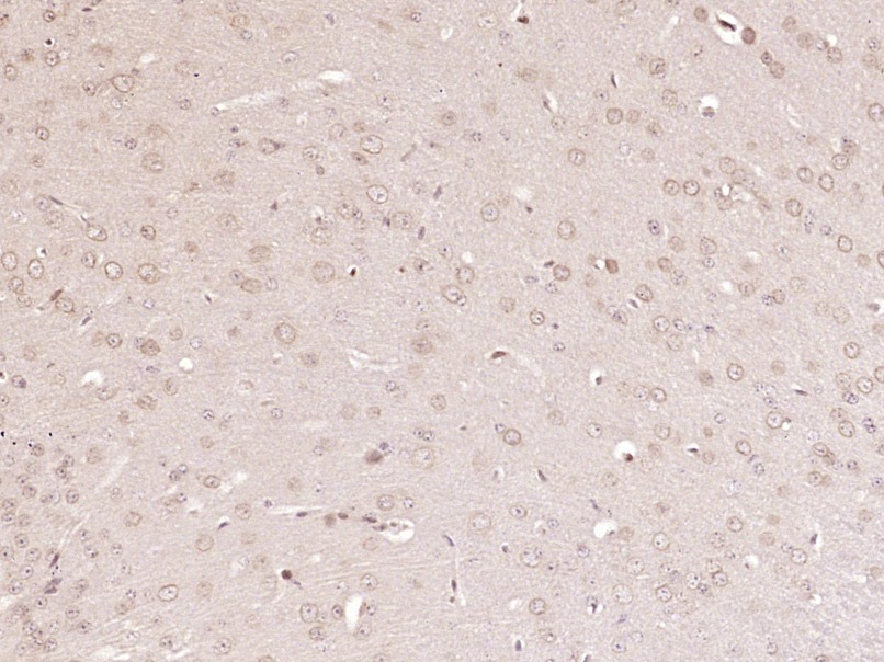 Anti-PIK3CA Polyclonal Antibody
