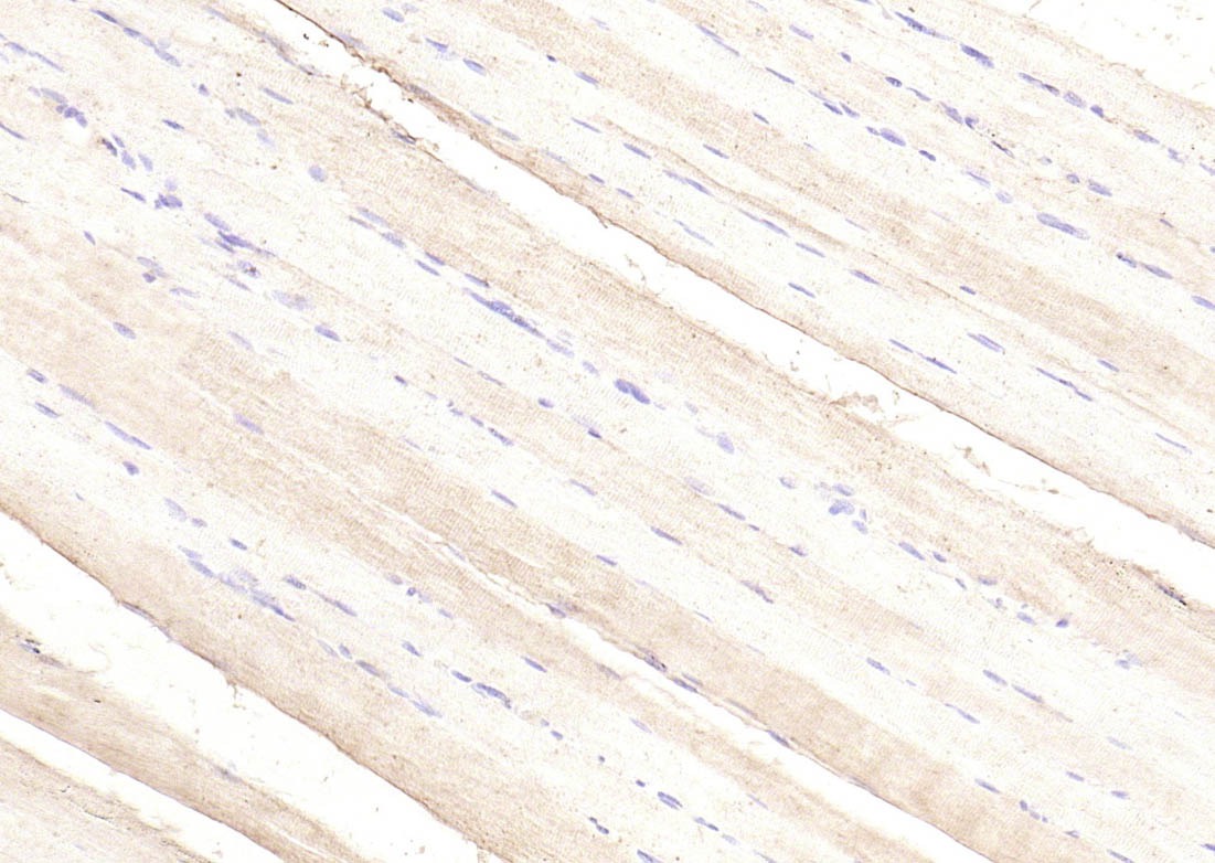 Anti-PIK3R1 Polyclonal Antibody