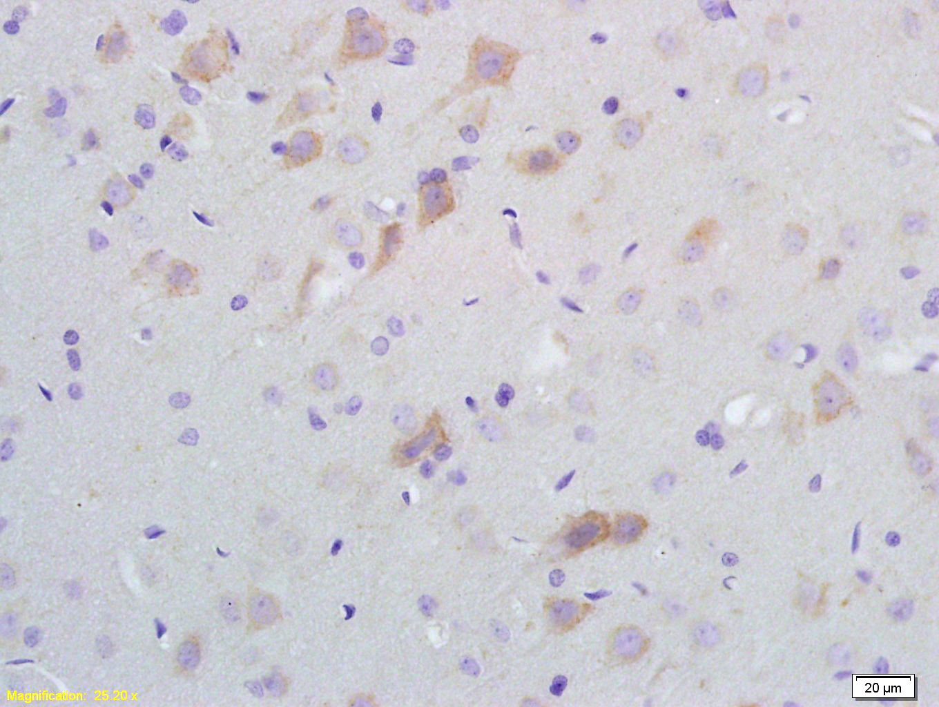 Anti-SCD1 Polyclonal Antibody