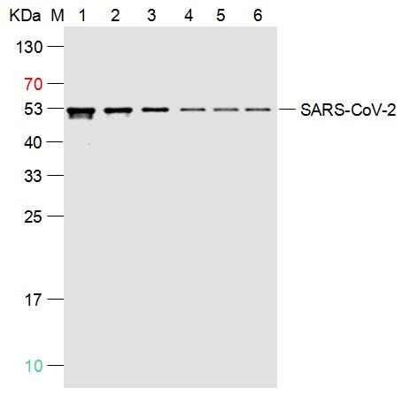Anti-SARS-CoV-2 (2019-nCoV) Nucleocapsid, WT & Ormicron Recognized Antibody (6F930)