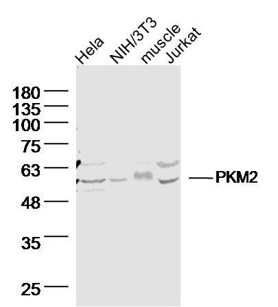 Anti-PKM2 Polyclonal Antibody