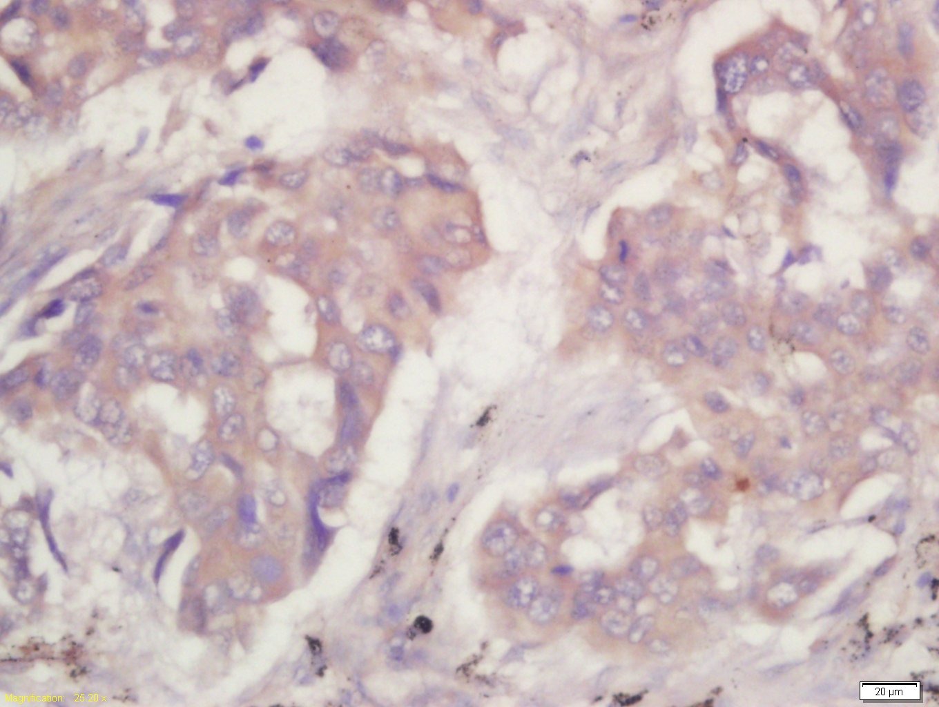 Anti-PKM2 Polyclonal Antibody 2