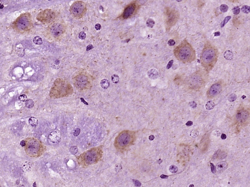 Anti-SCD1 Polyclonal Antibody