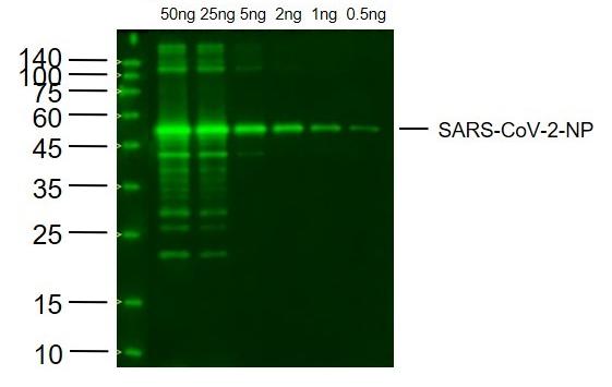 Anti-SARS-CoV-2 (2019-nCoV) Nucleocapsid Antibody (5C944)
