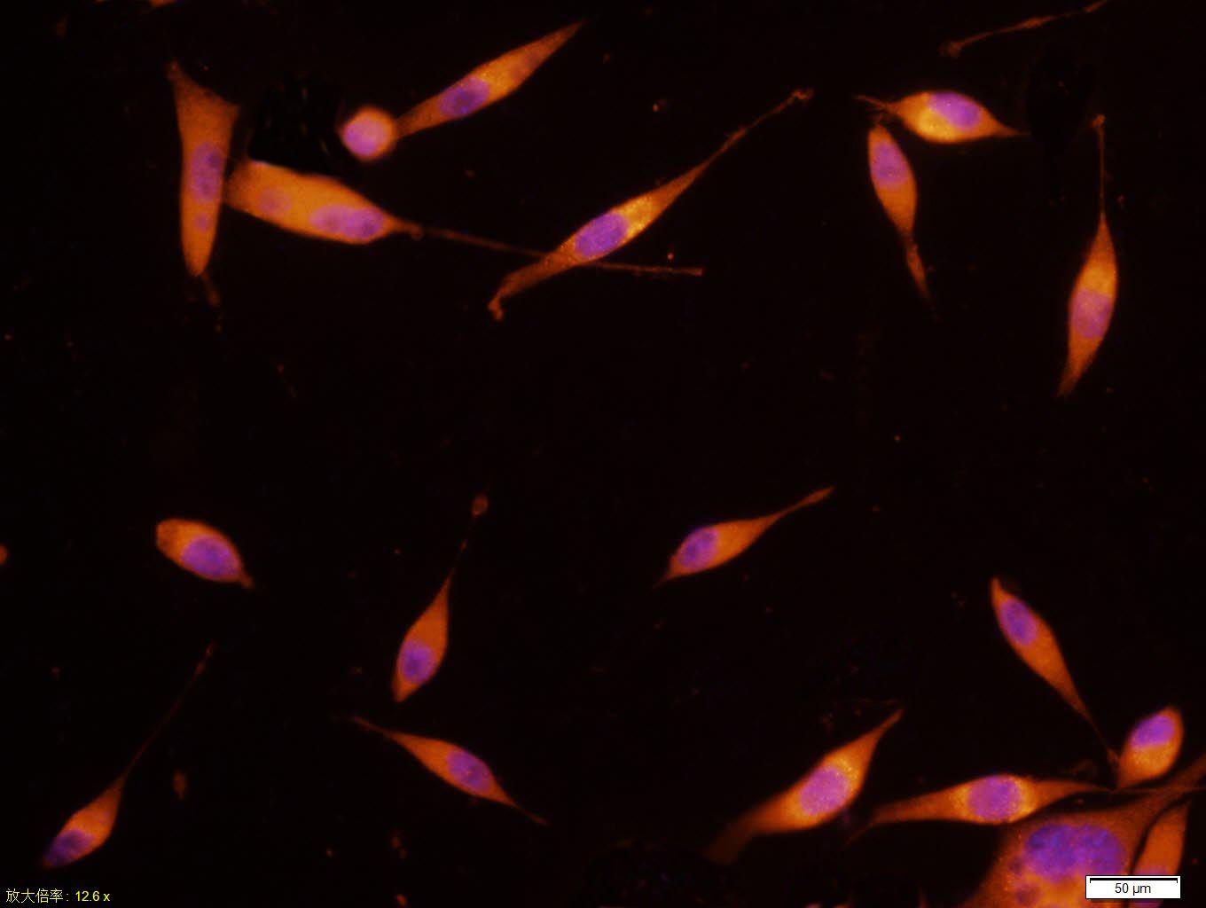 Anti-PIK3R1 Antibody (1Z225)