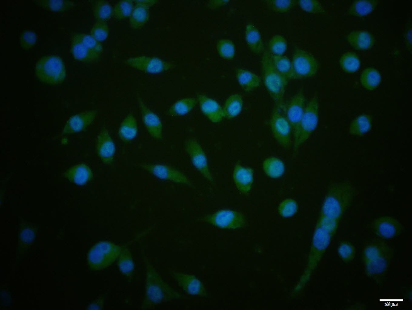 Anti-PIK3CA Polyclonal Antibody