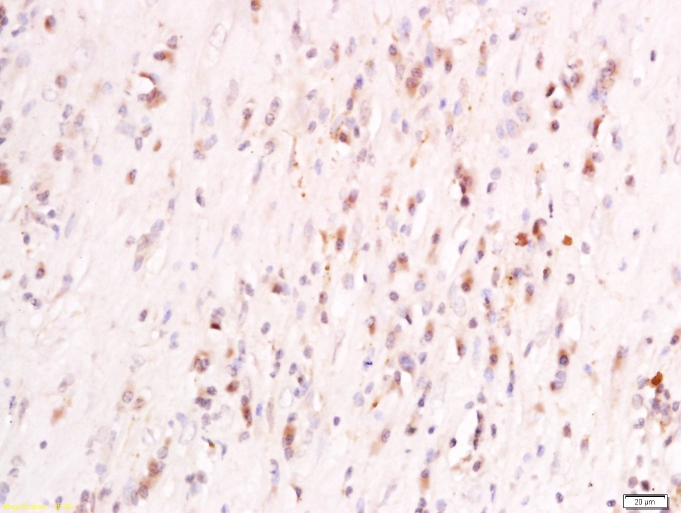 Anti-PIGR Polyclonal Antibody