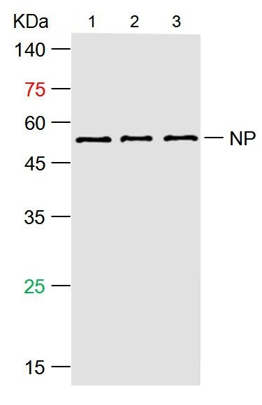Anti-SARS-CoV-2 (2019-nCoV) Nucleocapsid, WT & Ormicron Recognized Antibody (6F930)