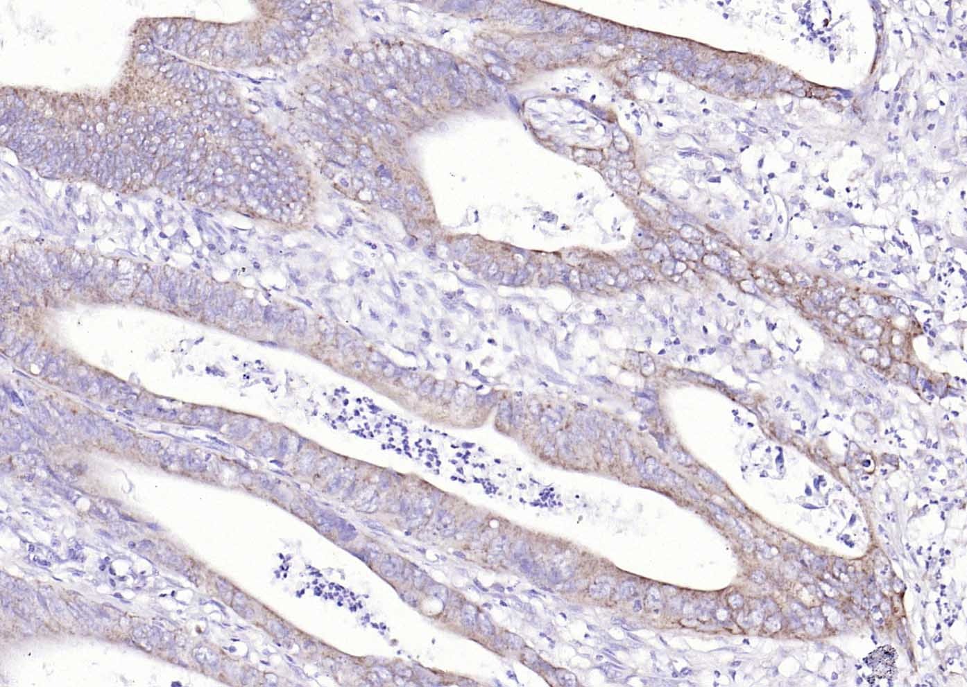 Anti-SCD1 Polyclonal Antibody