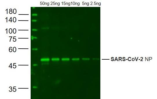 Anti-SARS-CoV-2 N Polyclonal Antibody