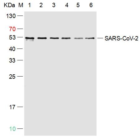 Anti-SARS-CoV-2 (2019-nCoV) Nucleocapsid,  WT & Ormicron Recognized Antibody (8M778)