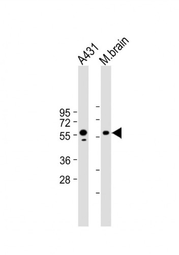 Anti-PINK1 Antibody (1K285)