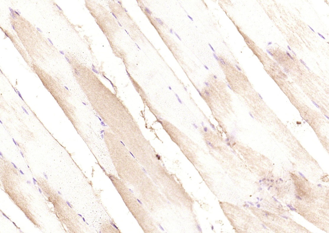 Anti-PIK3R1 Polyclonal Antibody