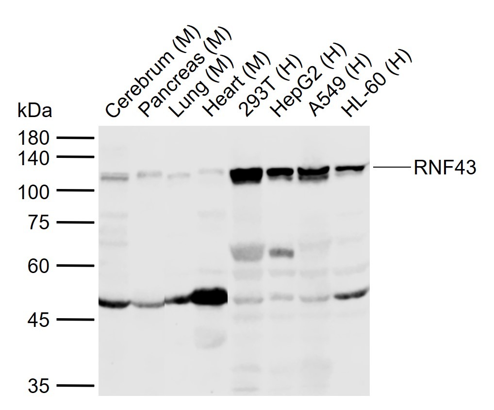 Anti-RNF43 Polyclonal Antibody